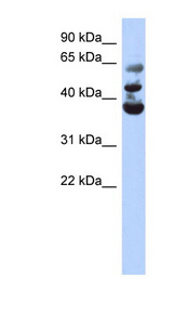 NSUN3 Antibody - NSUN3 antibody Western blot of Fetal Pancreas lysate. This image was taken for the unconjugated form of this product. Other forms have not been tested.