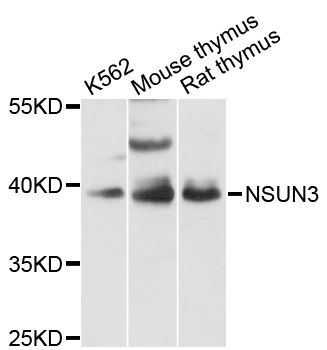 NSUN3 Antibody - Western blot analysis of extracts of various cell lines, using NSUN3 antibody at 1:3000 dilution. The secondary antibody used was an HRP Goat Anti-Rabbit IgG (H+L) at 1:10000 dilution. Lysates were loaded 25ug per lane and 3% nonfat dry milk in TBST was used for blocking. An ECL Kit was used for detection and the exposure time was 30s.