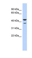 NSUN4 Antibody - NSUN4 antibody Western blot of Fetal Heart lysate. This image was taken for the unconjugated form of this product. Other forms have not been tested.