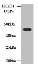 NSUN4 Antibody - Western blot All lanes: NSUN4 antibody at 0.6µg/ml + 293T whole cell lysate Secondary Goat polyclonal to rabbit IgG at 1/10000 dilution Predicted band size: 44, 17, 22, 38 kDa Observed band size: 44 kDa