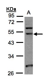 NSUN6 Antibody - Sample (30 ug whole cell lysate). A:293T. 10% SDS PAGE. NSUN6 antibody diluted at 1:1000