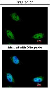 NSUN6 Antibody - Immunofluorescence of paraformaldehyde-fixed HeLa using NSUN6 antibody at 1:200 dilution.