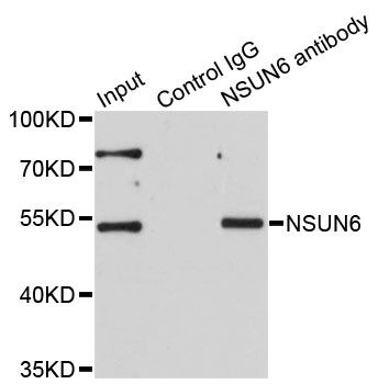 NSUN6 Antibody - Immunoprecipitation analysis of 200ug extracts of HeLa cells.