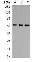 NSUN6 Antibody - Western blot analysis of NSUN6 expression in HepG2 (A); HeLa (B); mouse testis (C) whole cell lysates.