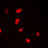 NSUN6 Antibody - Immunofluorescent analysis of NSUN6 staining in MCF7 cells. Formalin-fixed cells were permeabilized with 0.1% Triton X-100 in TBS for 5-10 minutes and blocked with 3% BSA-PBS for 30 minutes at room temperature. Cells were probed with the primary antibody in 3% BSA-PBS and incubated overnight at 4 deg C in a humidified chamber. Cells were washed with PBST and incubated with a DyLight 594-conjugated secondary antibody (red) in PBS at room temperature in the dark.