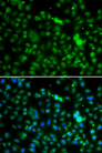 NSUN6 Antibody - Immunofluorescence analysis of MCF-7 cells using NSUN6 antibody. Blue: DAPI for nuclear staining.
