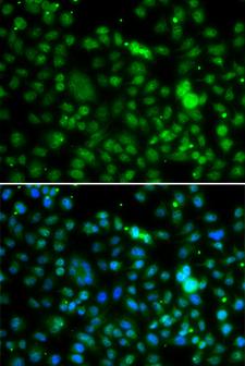 NSUN6 Antibody - Immunofluorescence analysis of MCF-7 cells using NSUN6 antibody. Blue: DAPI for nuclear staining.