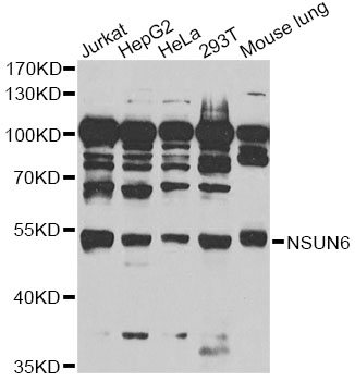 NSUN6 Antibody - Western blot analysis of extracts of various cell lines, using NSUN6 antibody at 1:1000 dilution. The secondary antibody used was an HRP Goat Anti-Rabbit IgG (H+L) at 1:10000 dilution. Lysates were loaded 25ug per lane and 3% nonfat dry milk in TBST was used for blocking. An ECL Kit was used for detection and the exposure time was 90s.