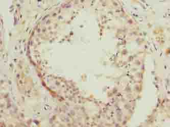 NSUN7 Antibody - Immunohistochemistry of paraffin-embedded human testis tissue using antibody at dilution of 1:100.