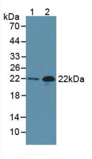 NT-proBNP Antibody - Western blot.  Lane 1: human serum; Lane 2: rat heart
