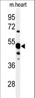 NT5C1A / CN1A Antibody - Western blot of 5NT1A Antibody in mouse heart tissue lysates (35 ug/lane). 5NT1A (arrow) was detected using the purified antibody.
