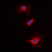 NT5C1A / CN1A Antibody - Immunofluorescent analysis of NT5C1A staining in HepG2 cells. Formalin-fixed cells were permeabilized with 0.1% Triton X-100 in TBS for 5-10 minutes and blocked with 3% BSA-PBS for 30 minutes at room temperature. Cells were probed with the primary antibody in 3% BSA-PBS and incubated overnight at 4 deg C in a humidified chamber. Cells were washed with PBST and incubated with a DyLight 594-conjugated secondary antibody (red) in PBS at room temperature in the dark. DAPI was used to stain the cell nuclei (blue).