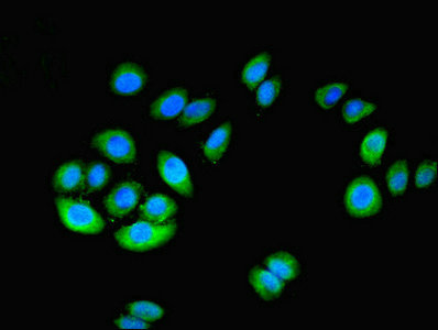 NT5C1A / CN1A Antibody - Immunofluorescent analysis of A549 cells using NT5C1A Antibody at dilution of 1:100 and Alexa Fluor 488-congugated AffiniPure Goat Anti-Rabbit IgG(H+L)