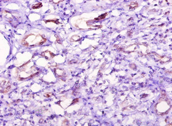 NT5C1A / CN1A Antibody - Immunohistochemistry of paraffin-embedded human kidney tissue using NT5C1A Antibody at dilution of 1:10