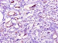 NT5C1A / CN1A Antibody - Immunohistochemistry of paraffin-embedded human kidney tissue using NT5C1A Antibody at dilution of 1:10