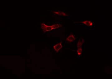 NT5C1A / CN1A Antibody - Staining MCF-7 cells by IF/ICC. The samples were fixed with PFA and permeabilized in 0.1% Triton X-100, then blocked in 10% serum for 45 min at 25°C. The primary antibody was diluted at 1:200 and incubated with the sample for 1 hour at 37°C. An Alexa Fluor 594 conjugated goat anti-rabbit IgG (H+L) antibody, diluted at 1/600, was used as secondary antibody.