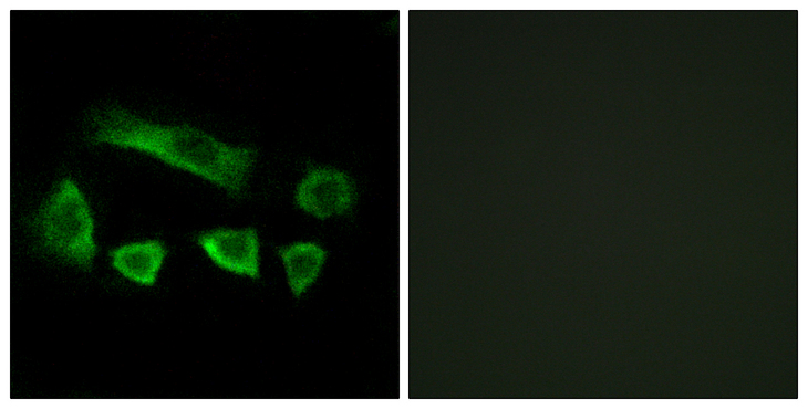 NT5C1B Antibody - Immunofluorescence analysis of A549 cells, using NT5C1B Antibody. The picture on the right is blocked with the synthesized peptide.