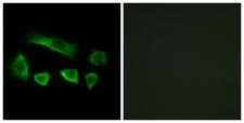 NT5C1B Antibody - Immunofluorescence analysis of A549 cells, using NT5C1B Antibody. The picture on the right is blocked with the synthesized peptide.