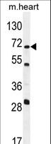 NT5C1B Antibody - NT5C1B Antibody western blot of mouse heart tissue lysates (35 ug/lane). The NT5C1B antibody detected the NT5C1B protein (arrow).
