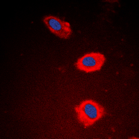 NT5C1B Antibody - Immunofluorescent analysis of NT5C1B staining in EAhy926 cells. Formalin-fixed cells were permeabilized with 0.1% Triton X-100 in TBS for 5-10 minutes and blocked with 3% BSA-PBS for 30 minutes at room temperature. Cells were probed with the primary antibody in 3% BSA-PBS and incubated overnight at 4 C in a humidified chamber. Cells were washed with PBST and incubated with a DyLight 594-conjugated secondary antibody (red) in PBS at room temperature in the dark. DAPI was used to stain the cell nuclei (blue).