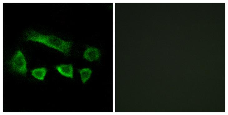 NT5C1B Antibody - Peptide - + Immunofluorescence analysis of A549 cells, using NT5C1B antibody.