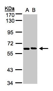 NT5C2 Antibody - Sample (30 ug whole cell lysate). A: H1299, B: HeLa S3. 7.5% SDS PAGE. NT5C2 antibody diluted at 1:1000