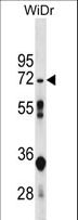 NT5C2 Antibody - NT5C2 Antibody western blot of WiDr cell line lysates (35 ug/lane). The NT5C2 antibody detected the NT5C2 protein (arrow).