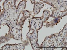 NT5C2 Antibody - Immunoperoxidase of monoclonal antibody to NT5C2 on formalin-fixed paraffin-embedded human placenta. [antibody concentration 3 ug/ml]