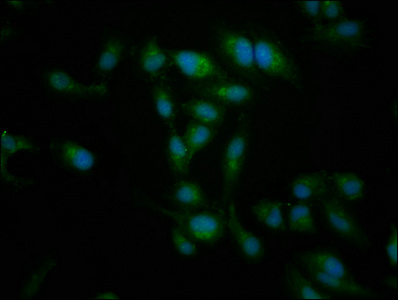 NT5C2 Antibody - Immunofluorescence staining of Hela cells at a dilution of 1:266, counter-stained with DAPI. The cells were fixed in 4% formaldehyde, permeabilized using 0.2% Triton X-100 and blocked in 10% normal Goat Serum. The cells were then incubated with the antibody overnight at 4 °C.The secondary antibody was Alexa Fluor 488-congugated AffiniPure Goat Anti-Rabbit IgG (H+L) .