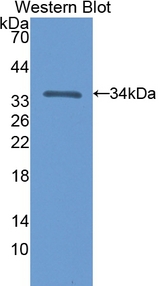 NT5C3A Antibody