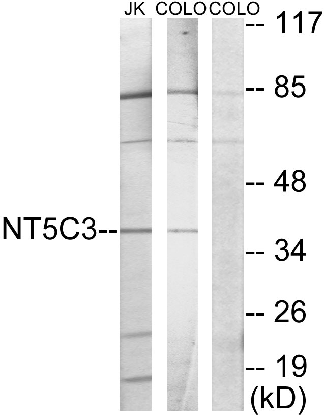 NT5C3A Antibody - Western blot analysis of lysates from Jurkat and COLO205 cells, using NT5C3 Antibody. The lane on the right is blocked with the synthesized peptide.