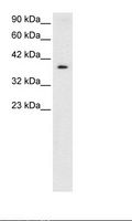 NT5C3A Antibody - HepG2 Cell Lysate.  This image was taken for the unconjugated form of this product. Other forms have not been tested.