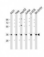 NT5C3A Antibody - All lanes: Anti-NT5C3 Antibody (C-Term) at 1:2000 dilution. Lane 1: A431 whole cell lysate. Lane 2: HeLa whole cell lysate. Lane 3: HepG2 whole cell lysate. Lane 4: Jurkat whole cell lysate. Lane 5: U-2OS whole cell lysate. Lane 6: SH-SY5Y whole cell lysate Lysates/proteins at 20 ug per lane. Secondary Goat Anti-Rabbit IgG, (H+L), Peroxidase conjugated at 1:10000 dilution. Predicted band size: 38 kDa. Blocking/Dilution buffer: 5% NFDM/TBST.