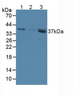 NT5C3A Antibody - Western Blot; Sample: Lane1: Human Liver Tissue; Lane2: Human Lung Tissue; Lane3: Rat Heart Tissue.