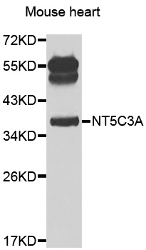 NT5C3A Antibody - Western blot analysis of extracts of mouse heart.