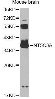 NT5C3A Antibody - Western blot analysis of extracts of mouse brain, using NT5C3A antibody at 1:1000 dilution. The secondary antibody used was an HRP Goat Anti-Rabbit IgG (H+L) at 1:10000 dilution. Lysates were loaded 25ug per lane and 3% nonfat dry milk in TBST was used for blocking. An ECL Kit was used for detection and the exposure time was 90s.