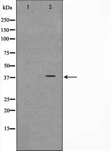 NT5C3A Antibody - Western blot analysis on Jurkat cell lysates using NT5C3 antibody. The lane on the left is treated with the antigen-specific peptide.