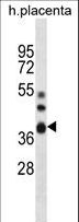 NT5C3B / NT5C3L Antibody - NT5C3L Antibody western blot of human placenta tissue lysates (35 ug/lane). The NT5C3L antibody detected the NT5C3L protein (arrow).