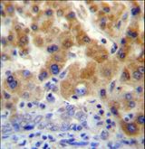 NT5C3B / NT5C3L Antibody - NT5C3L Antibody immunohistochemistry of formalin-fixed and paraffin-embedded human liver tissue followed by peroxidase-conjugated secondary antibody and DAB staining.