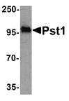 NT5C3B / NT5C3L Antibody - Western blot analysis of TM yeast Pst1 protein (50 ng) with Pst1 antibody at 1 ug/ml.