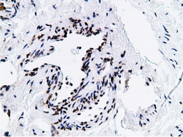 NT5DC1 Antibody - IHC of paraffin-embedded Human Ovary tissue using anti-NT5DC1 mouse monoclonal antibody.