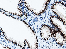 NT5DC1 Antibody - IHC of paraffin-embedded Human prostate tissue using anti-NT5DC1 mouse monoclonal antibody.