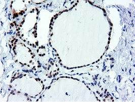 NT5DC1 Antibody - IHC of paraffin-embedded Human thyroid tissue using anti-NT5DC1 mouse monoclonal antibody.