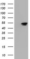 NT5DC1 Antibody - HEK293T cells were transfected with the pCMV6-ENTRY control (Left lane) or pCMV6-ENTRY NT5DC1 (Right lane) cDNA for 48 hrs and lysed. Equivalent amounts of cell lysates (5 ug per lane) were separated by SDS-PAGE and immunoblotted with anti-NT5DC1.