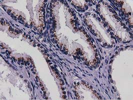 NT5DC1 Antibody - IHC of paraffin-embedded Human prostate tissue using anti-NT5DC1 mouse monoclonal antibody.