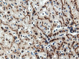 NT5DC1 Antibody - Immunohistochemical staining of paraffin-embedded Human liver tissue using anti-NT5DC1 mouse monoclonal antibody.