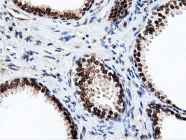 NT5DC1 Antibody - Immunohistochemical staining of paraffin-embedded Human prostate tissue using anti-NT5DC1 mouse monoclonal antibody.