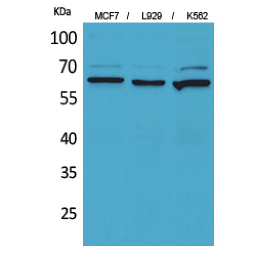 NT5E / eNT / CD73 Antibody - Western blot of CD73 antibody
