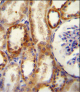 NT5E / eNT / CD73 Antibody - CD73 (NT5E) Antibody immunohistochemistry of formalin-fixed and paraffin-embedded human kidney tissue followed by peroxidase-conjugated secondary antibody and DAB staining.
