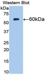 NT5E / eNT / CD73 Antibody - Western blot of recombinant NT5E / eNT / CD73.